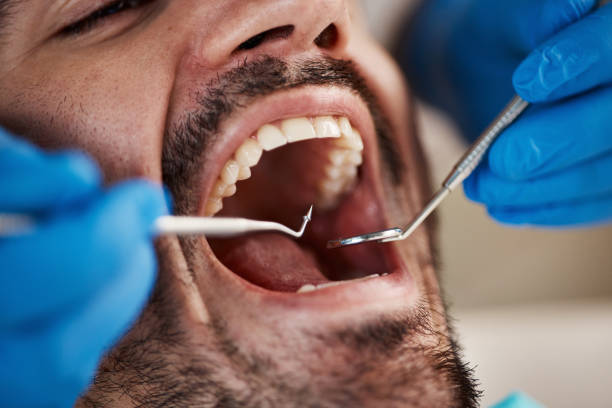 Best Emergency Denture Repair in Cutchogue, NY